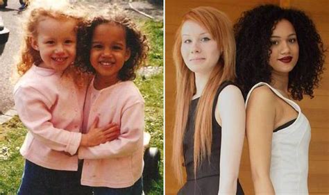 Meet the TWINS with different coloured hair, eyes and skin | UK | News | Express.co.uk