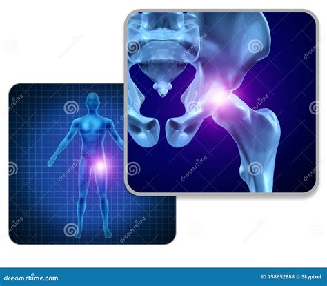 Human Hip Joint Pain stock illustration. Illustration of body - 158652888