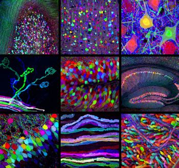 Brain's wiring seen in Technicolor