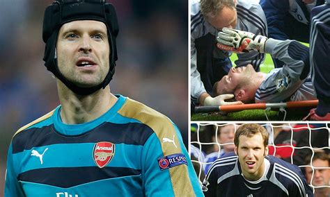 But Why Does Petr Čech Always Wear A Helmet? But Why Does, 48% OFF