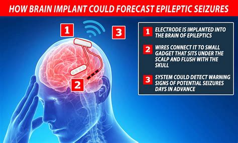 Epilepsy Warning Signs Of A Seizure / The Epilepsies And Seizures Hope ...