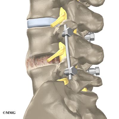 Patient Education | Concord Orthopaedics