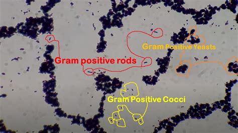 Gram Positive Under Microscope