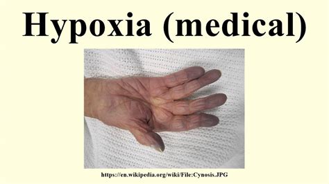 Hypoxia (medical) - YouTube