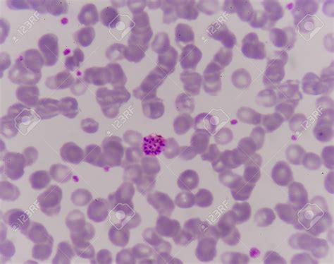 Free download Close Up Malaria Parasite In Blood Red Blood Cells Background [1300x1026] for your ...