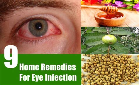 9 HOME REMEDIES FOR EYE INFECTION | Search Home Remedy