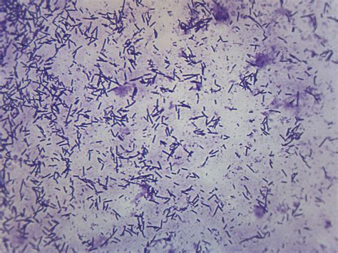 Escherichia Coli Smear - Prepared Microscope Slide - 75x25mm — Eisco Labs