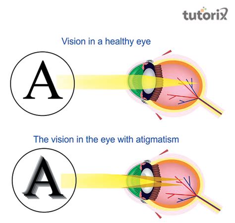 Toric Lens