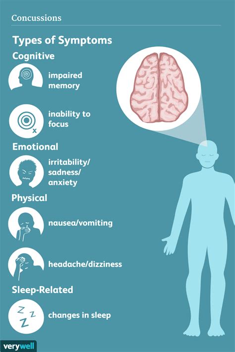 Concussion: Signs, Symptoms, and Complications