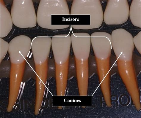 Incisor (s) | Ask A Dentist