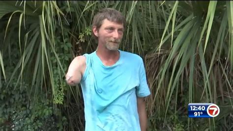 Florida man who lost arm in alligator attack speaks out – WSVN 7News ...