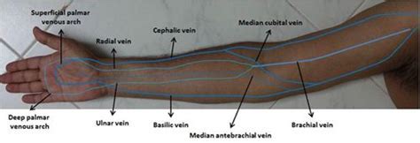 Upper Extremity Venous Anatomy