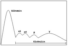 Monoclonal gammopathy of undetermined significance - Wikipedia, the ...