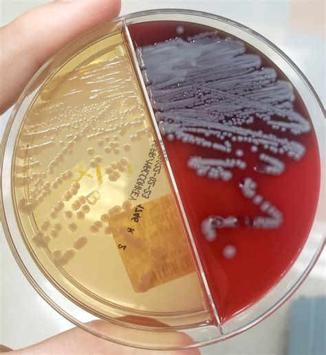 Serratia Marcescens Colony Morphology