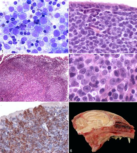 Large Diffuse B Cell Lymphoma Symptoms