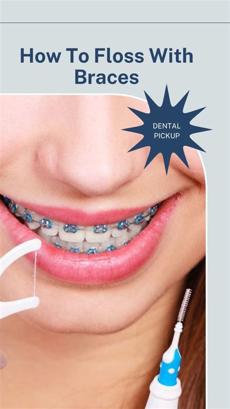 How To Floss With Braces? A Completed Guide - Dental Pickup