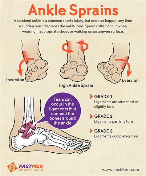 How to Use a Sam Splint to Treat Bone Fractures | Worst injuries, Ankle joint and Bone fracture