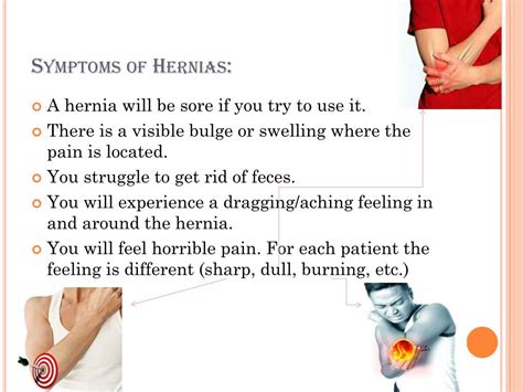 PPT - Hernia PowerPoint Presentation, free download - ID:2659430