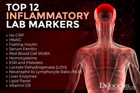 Top 12 Inflammatory Lab Markers and Optimal Ranges