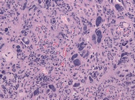 Difference Between | Tissue types, Atypical cells, Abnormal cells