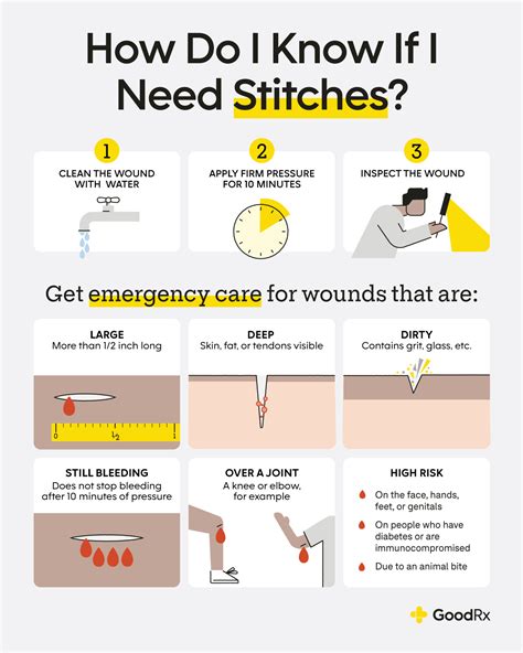 How to know if a wound is too deep that we need to see a doctor? : r ...