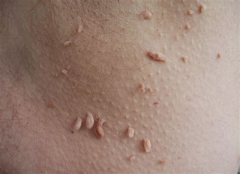 MedFriendly Medical Blog: Beyond 40: Common Skin Problems & Treatment Options