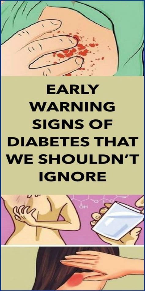 10 Early Warning Signs Of Diabetes Everyone Should Know! | mooseteaparty