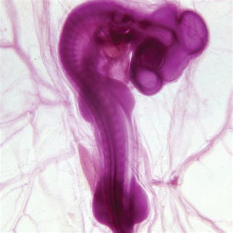 Chick Embryo, 72 hour Microscope Slides | Carolina.com