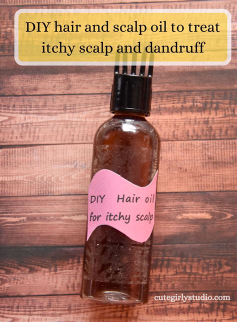 DIY hair and scalp oil to treat itchy scalp and dandruff | Cute girly studio | Scalp oil, Itchy ...