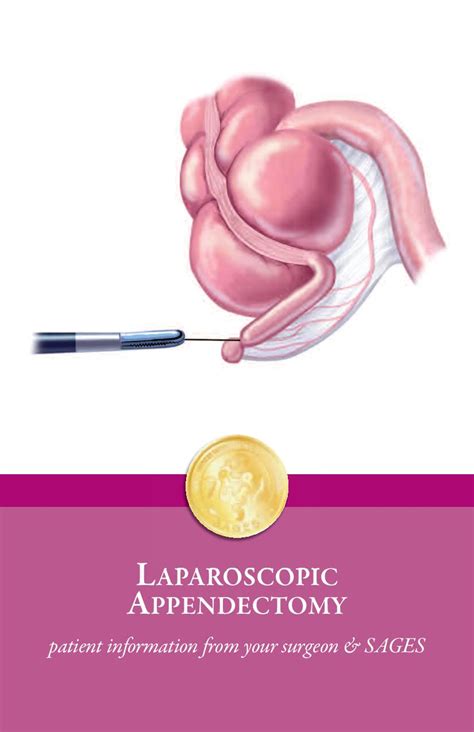 Laparoscopic Appendix Removal (Appendectomy) Surgery Patient Information