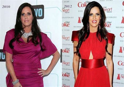 Patti Stanger Plastic Surgery Before And After Photos