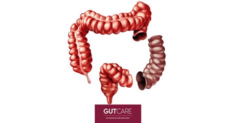 Understanding Colectomy Procedures & Why They Are Conducted | GUTCARE