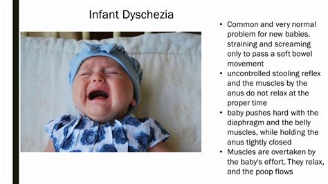 infant dyschezia - YouTube