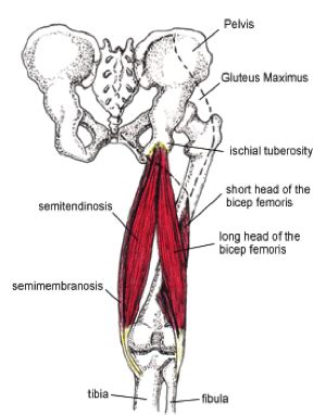 Proximal Hamstring Tendinopathy - Physiopedia