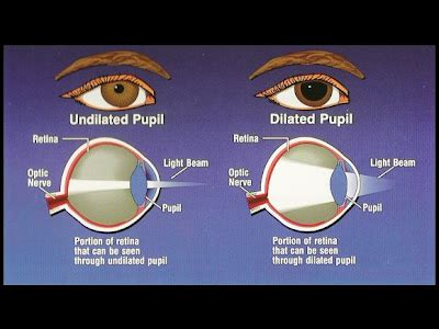 3 Blind Mice: Pupil Dilation