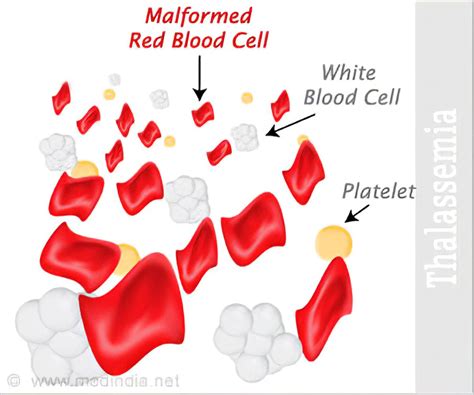 Thalassemia Blood Test