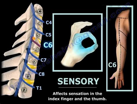 Neck Pain Cervical Disc Herniation And Radiculopathy | Images and Photos finder