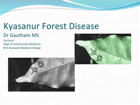 Kyasanur forest disease