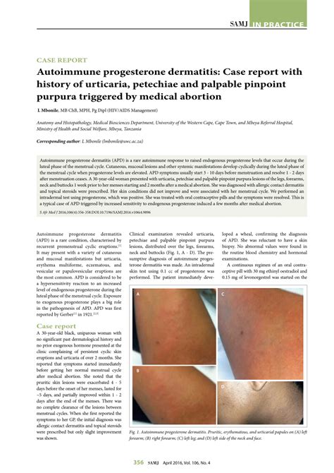 (PDF) Autoimmune progesterone dermatitis: Case report with history of ...