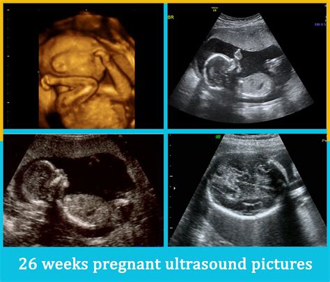 26 Weeks Pregnant Ultrasound Pictures - PREGNANTSH