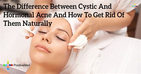 The Difference Between Cystic And Hormonal Acne And How To Get Rid Of ...