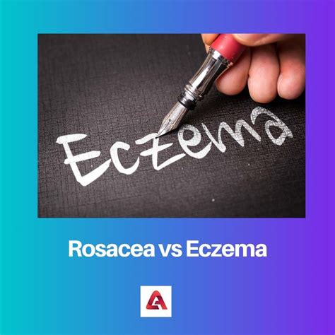 Rosacea vs Eczema: Difference and Comparison