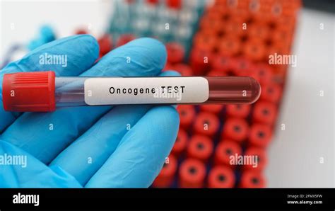 Oncogene test, cancer cell detection test result with blood sample in ...