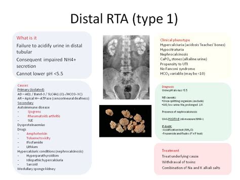 Distal Renal Tubular Acidosis Drta Diagnostic | SexiezPicz Web Porn