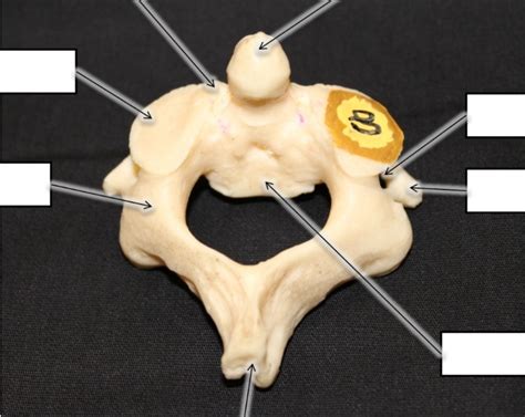 Axis Bone Diagram | Quizlet