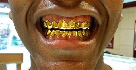 18K Solid Yellow Gold Custom fit REAL Gold Grill Grillz Gold Teeth