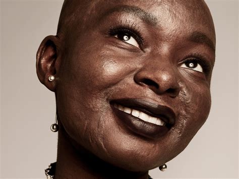 Beauty Vlogger Shalom Blac Opens Up About the Power of Makeup and Her Burn Scars | Glamour