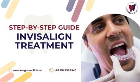 Invisalign Treatment Process: Step-by-Step Guide