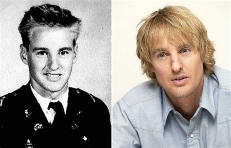 Owen Wilson Nose Job: Plastic Surgery and Rhinoplasty