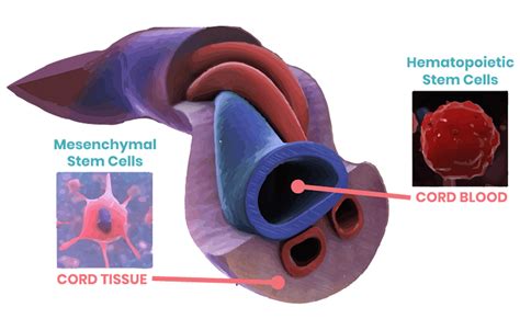 Umbilical Cord Stem Cell Therapy Process - Dr. Ramon - Ramon De La Puerta, MD